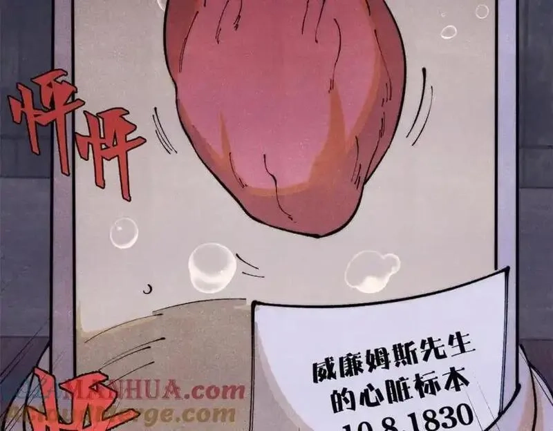玩家凶猛,119 异常器官,第57张